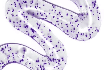 Are Microbeads in Your Drinking Water?