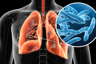 Remove Legionnaires Disease from Water