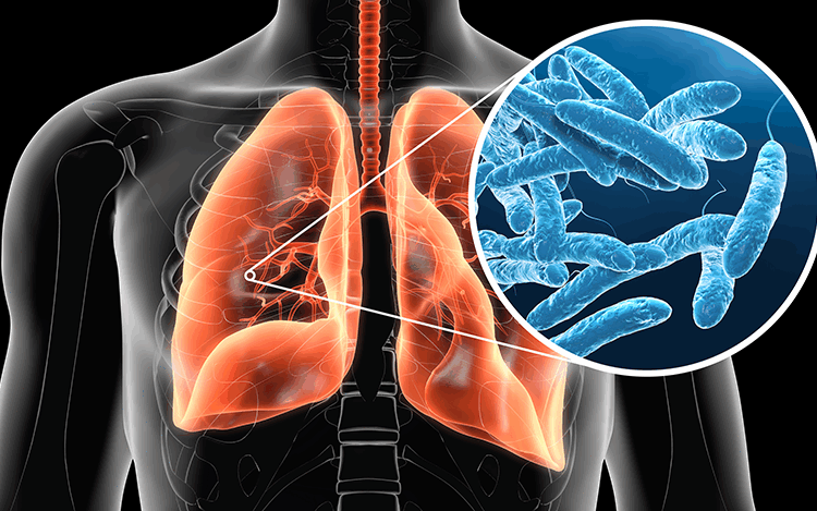 Remove Legionnaires Disease from Water