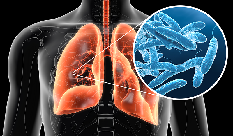 Remove Legionnaires Disease from Water