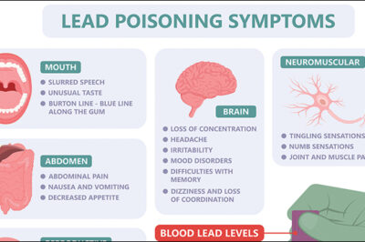 symptoms of lead poisoning